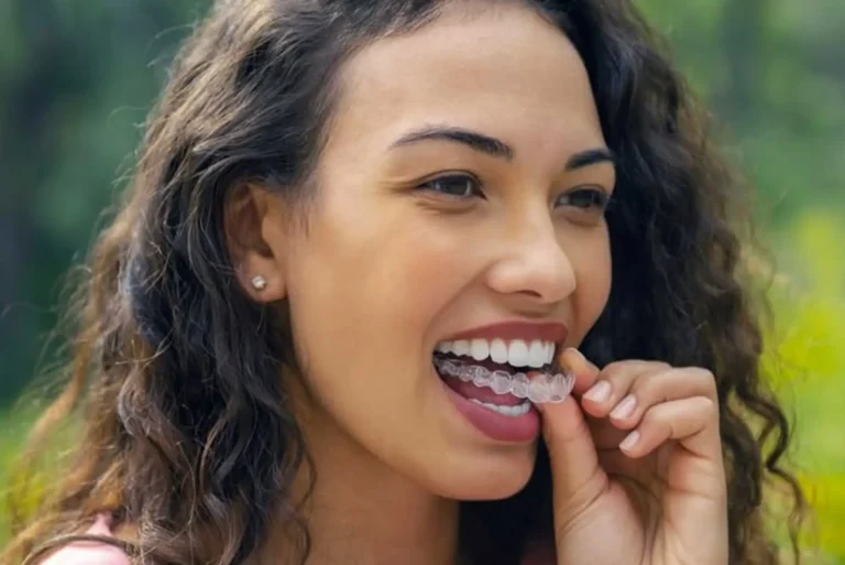 straightening-aligners@2x