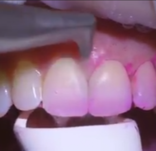 video placeholder image