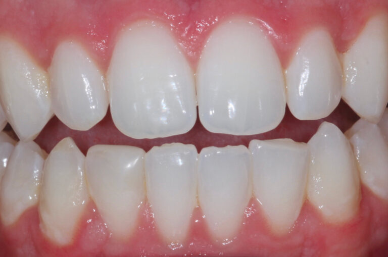 Case_study_6_after