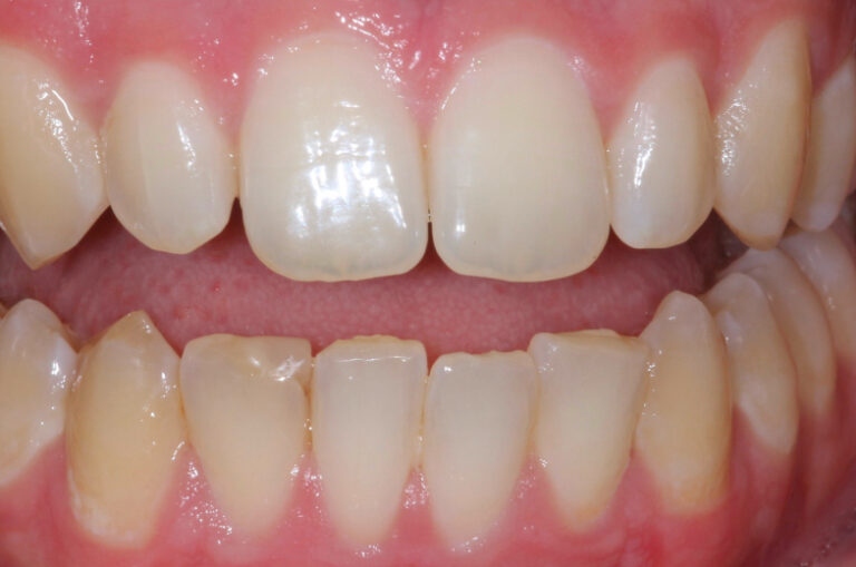 Case_study_6_before