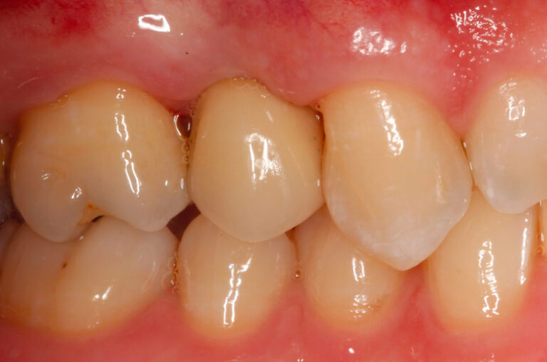 Website case 1_pt2_after