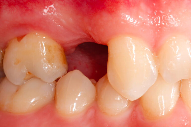 Website case 1_pt2_before